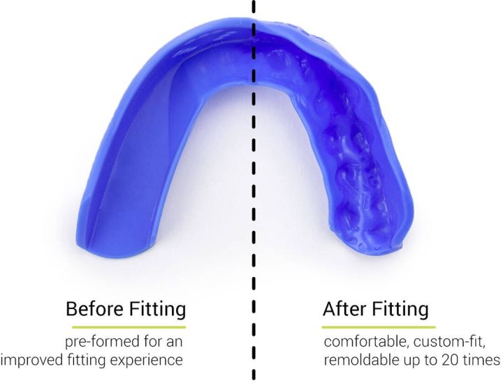 Протектор за зъби Sisu 3D Royal Blue